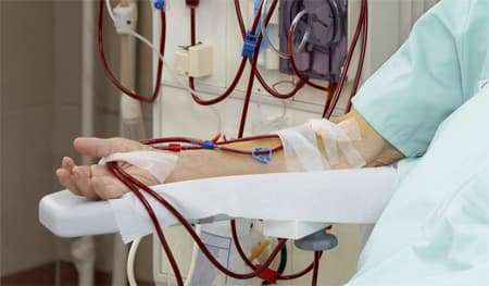 الصحة تؤمن أدوية مجانية لمرضى زرع الكلية
