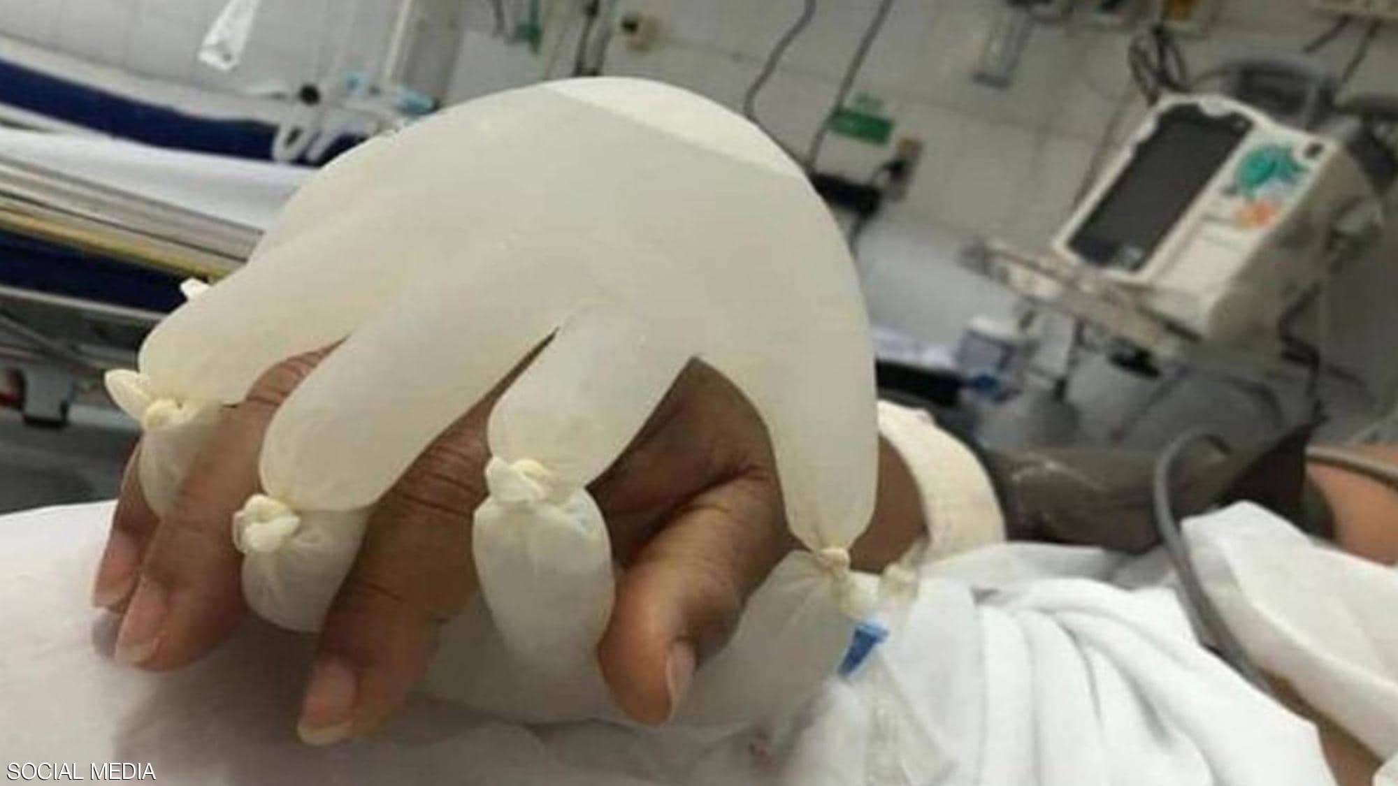 فكرة مبتكرة لدعم المصابين بفيروس كورونا